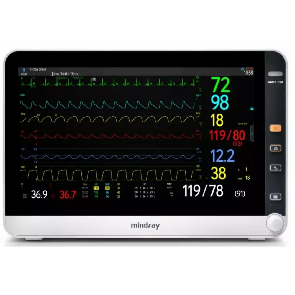 Mindray uMEC 150 Patient Monitor